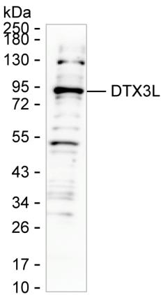 DTX3L